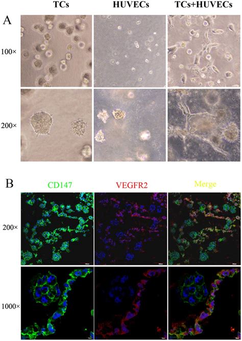 A Smmc Cells And Huvecs Were Seeded And Cultured In Matrigel