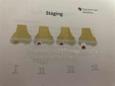 MSK III FINAL PED ADOLESCENT CONTENT Flashcards Quizlet