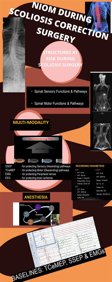 Info of the Day: "IONM During Scoliosis Correction Surgery"