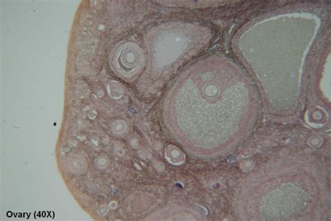 Ovary