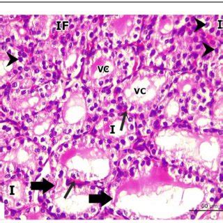 A Photomicrograph Of Transverse Section Of Thyroid Gland Of An Adult