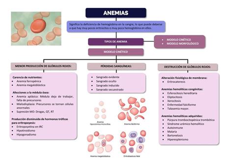 Tabla De Anemias Clasificacion Esquemas Y Mapas Conceptuales De Porn