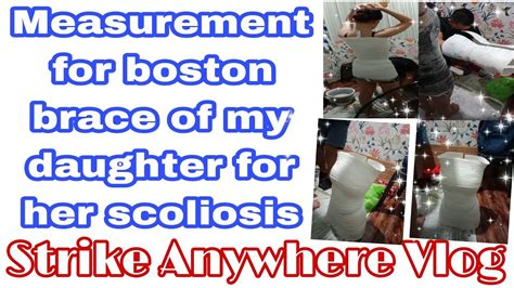 Measurement For Boston Brace Of Scoliosis Youtube