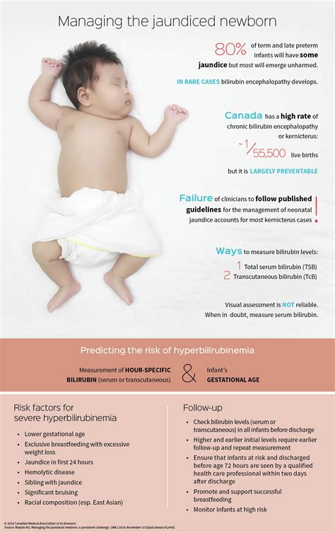 What Is Newborn Baby Jaundice at Jake Spragg blog