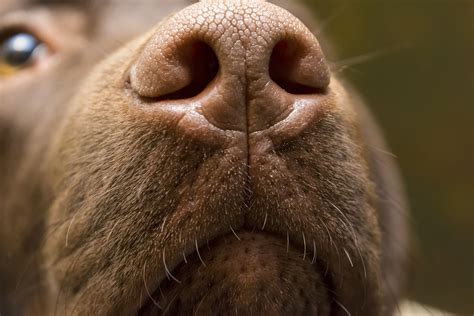 Un Homme Perd Ses Deux Jambes Apr S Avoir T L Ch Par Un Chien Top