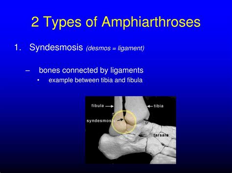 PPT - Articulations (Joints) PowerPoint Presentation, free download ...