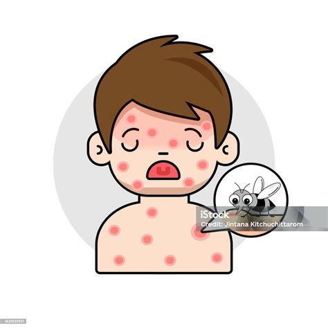 child  red rashes   body due   bitten   mosquito