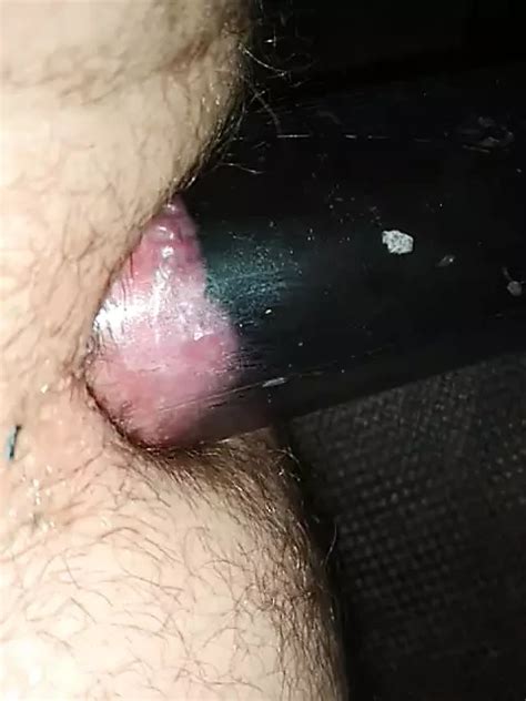 Pump Ass Prolaples Gay BDSM BDSM Porn Feat Artbigd XHamster