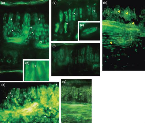 Cellular Localization Of Peach Latent Mosaic Viroid In Peach Sections By Liquid Phase In Situ Rt