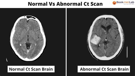 Ct Scan Brain Purpose Results And Cost 2025 • Bookmerilab