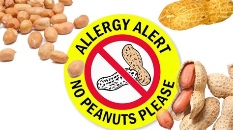 Peanut Allergic Reactions Chbi Inhibitor Prevent Allergic Reactions