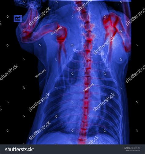 Xray Dog Posterior View Closed Thorax Stock Photo 1214235454 | Shutterstock