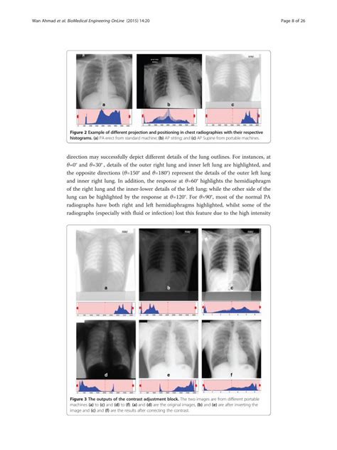 Pdf Lung Segmentation On Standard And Mobile Chest Pdf Filechest