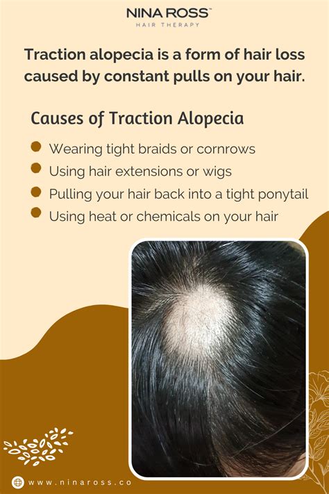 What causes Traction Alopecia?