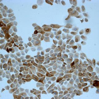 Light micrographs of the non-tumorigenic MCF-10A epithelial breast cell... | Download Scientific ...