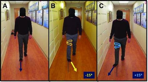 Total Knee Joint Replacement Are You Satisfied Gait Analysis