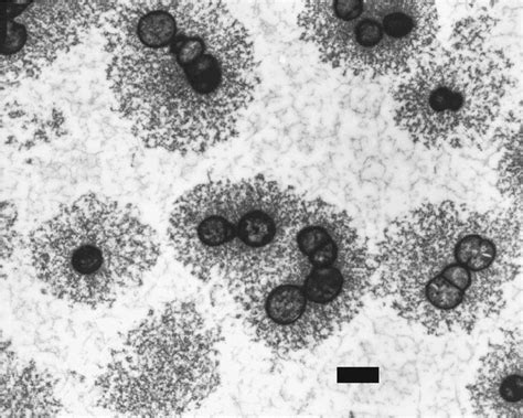 Strep Throat Virus Microscopic