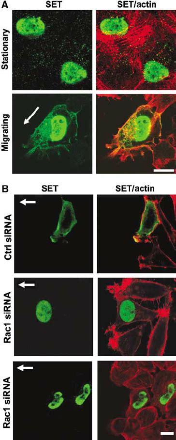 SET Translocates To The Plasma Membrane In Migrating Cells A