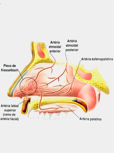 Sangramento Pelo Nariz E Boca - Epistaxe ou Sangramento Nasal - Dr José Alberto