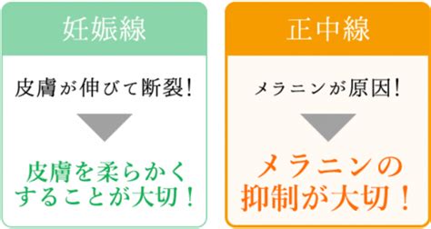 【正中線】妊娠中のお腹に縦の線！いつ消えるか教えます！ 妊婦力