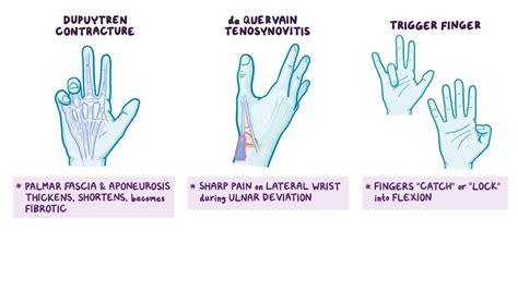 Anatomy Clinical Correlates Wrist And Hand Video Osmosis