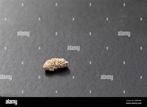 Struvite Kidney Stones