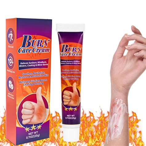 Burn Care Cream Scald Ointment Prevent Scars Moisturizing Analgesic ...