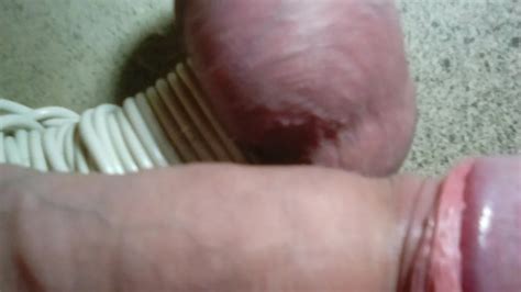 Jens Extrem Abgebundene Eier Adern Blau German Gay Amateur Porn XHamster