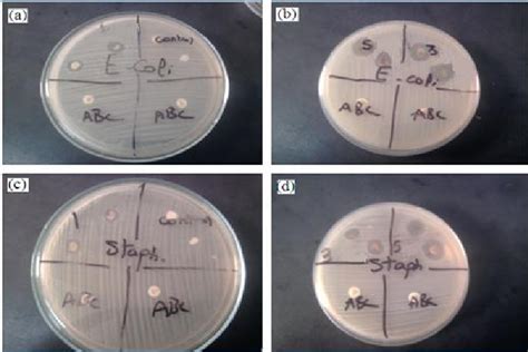 Agar Plates Showing Zones Of Inhibitions After H Of Incubation With