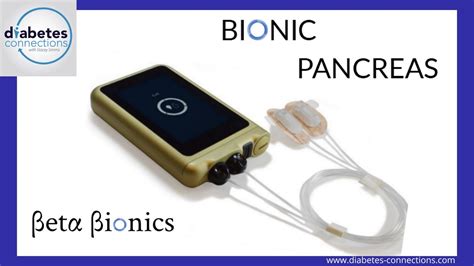 The ILet Bionic Pancreas An Update From Ed Damiano YouTube