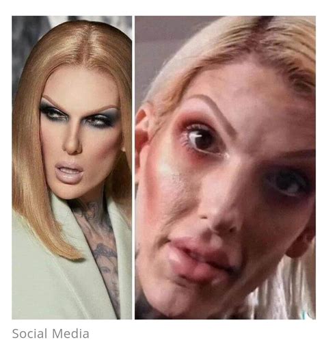 Madonna Plastic Surgeries Surgeon Reacts Artofit