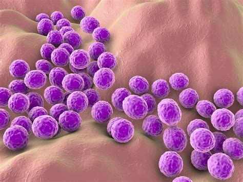 Staphylococcus Aureus Infection What It Is Symptoms Risks And Cure Fitnessequilibrium