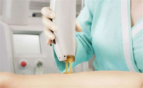 Q Switch Laser For Bikini Session Aida Clinic