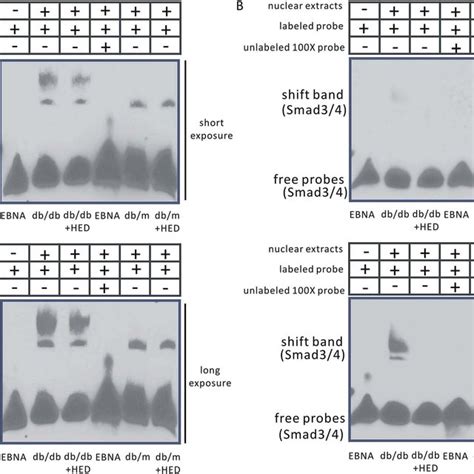 Emsa Assay Of Nf Kb And Smad A Changes In Nf Kb Transcriptional