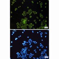 SLC27A4 Rabbit MAb NewEast Biosciences GTPase Oncogene And