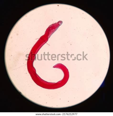 139 Schistosoma Japonicum Under Microscope Images Stock Photos