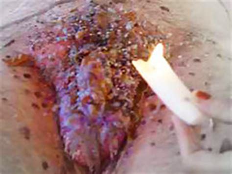 Torture Hard Porno Tubes Really Extreme Tit Torture Fully Hardcore Porno