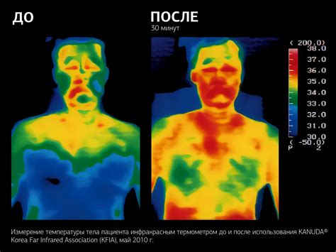 KANUDA® | Нэп для головы