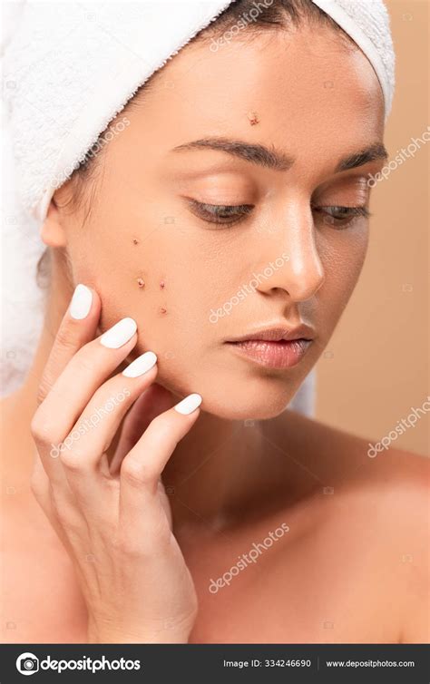 Naked Girl Towel Touching Face Acne Isolated Beige Stock Photo IgorVetushko