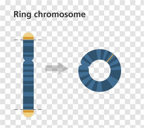 ring chromosome  syndrome abnormality genetics transparent png