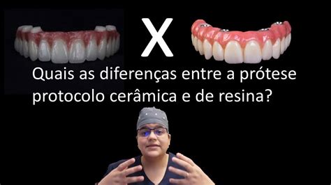 Diferença entre protocolo de porcelana e resina Dra Bianca Rosa