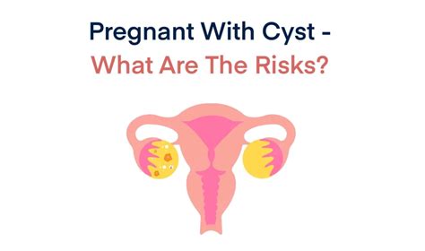 How To Get Pregnant With Ovarian Cysts Grace Fertility