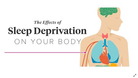 studies chronic sleep deprivation  toxic   gut health