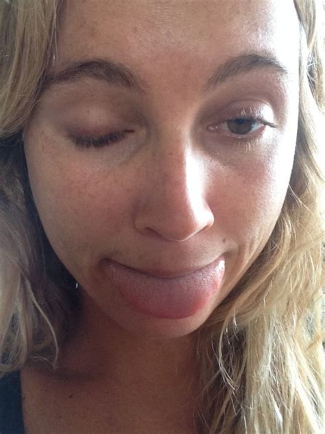 Alana Blanchard Naked Photos The Fappening