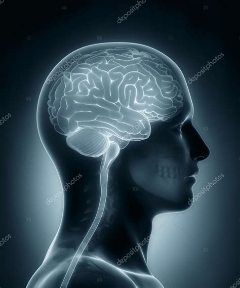 Human Brain Medical X Ray Scan Stock Photo Cliparea