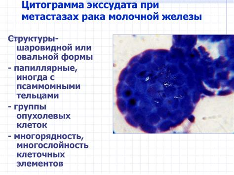Цитология молочной железы клетки с признаками атипии в цитологии - фото ...