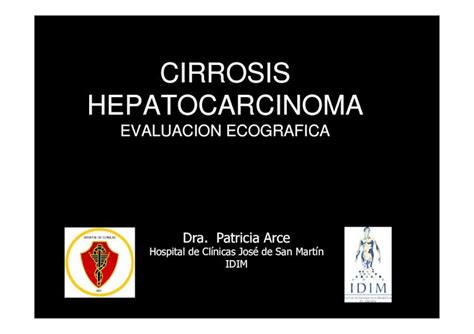 Pdf Cirrosis Hepatocarcinoma Hepatocarcinoma El Carcinoma