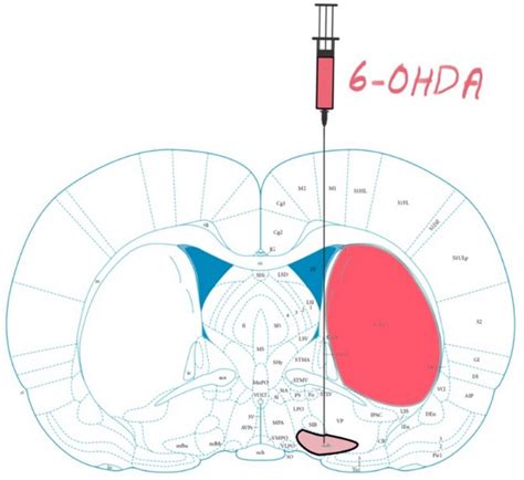 Rat Brain Atlas 6 Hydroxydopamine 6 Ohda Parkinsons Disease Pd