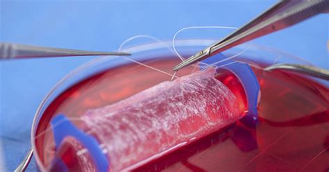 Bem Estar Pacientes Que Nasceram Sem Vagina Ganham Rg O Feito Suas C Lulas