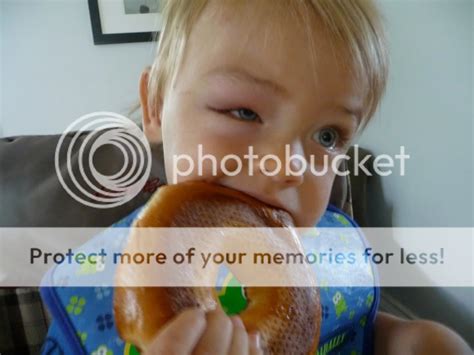 Swollen Eye Help Pics Included Babycenter